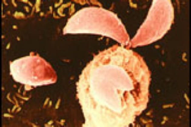 Come si contrae la toxoplasmosi? Come si contrae la toxoplasmosi?