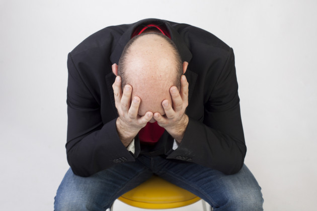 calvizie Uomo e calvizie