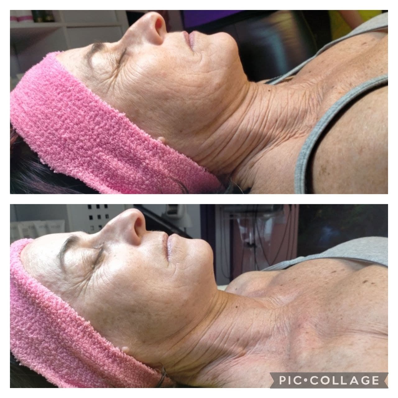 Anti Age Estetista Anti Age Estetista