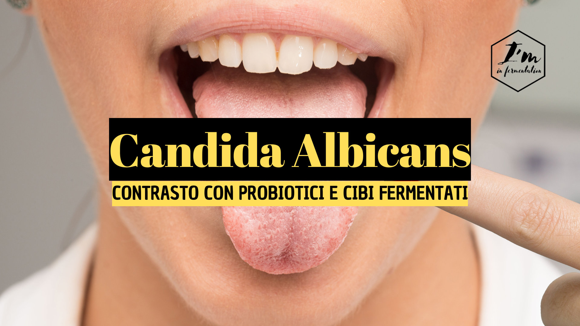 Probiotici vs Candida: Il Potere dei Fermentati senza Zucchero Probiotici vs Candida: Il Potere dei Fermentati senza Zucchero