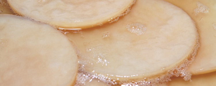 Scoby Hotel: Guida Completa per Creare e Mantenere il Tuo Hotel di Kombucha Scoby Hotel: Guida Completa per Creare e Mantenere il Tuo Hotel di Kombucha